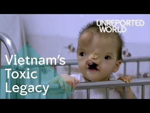 Child affected by Agent Orange — Vietnam's Toxic Legacy, Unreported World, Channel 4